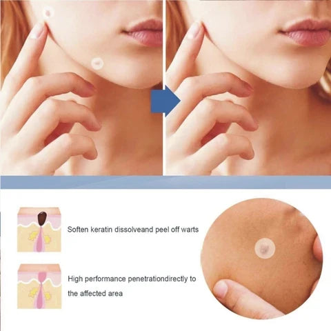 DermaSmooth Skin Tag Remover Patch – Fast, Safe & Painless Solution